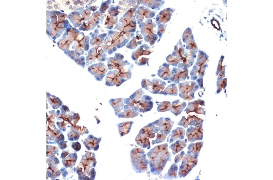 Immunohistochemistry - Anti-MUC1 Antibody (A89184) - Antibodies.com