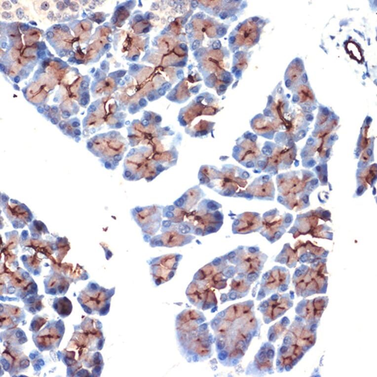 Immunohistochemistry - Anti-MUC1 Antibody (A89184) - Antibodies.com
