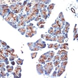 Immunohistochemistry - Anti-MUC1 Antibody (A89184) - Antibodies.com