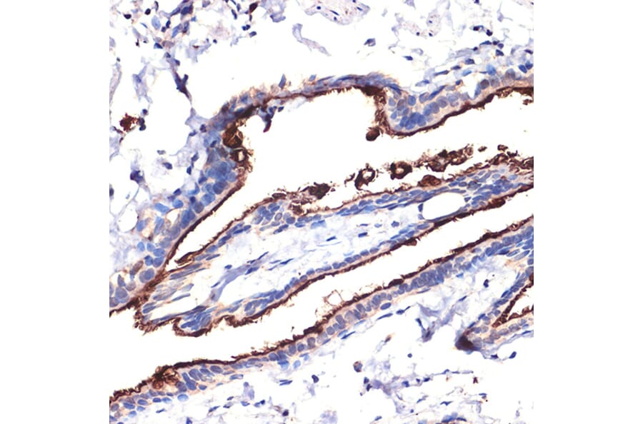 Immunohistochemistry - Anti-MUC1 Antibody (A89184) - Antibodies.com