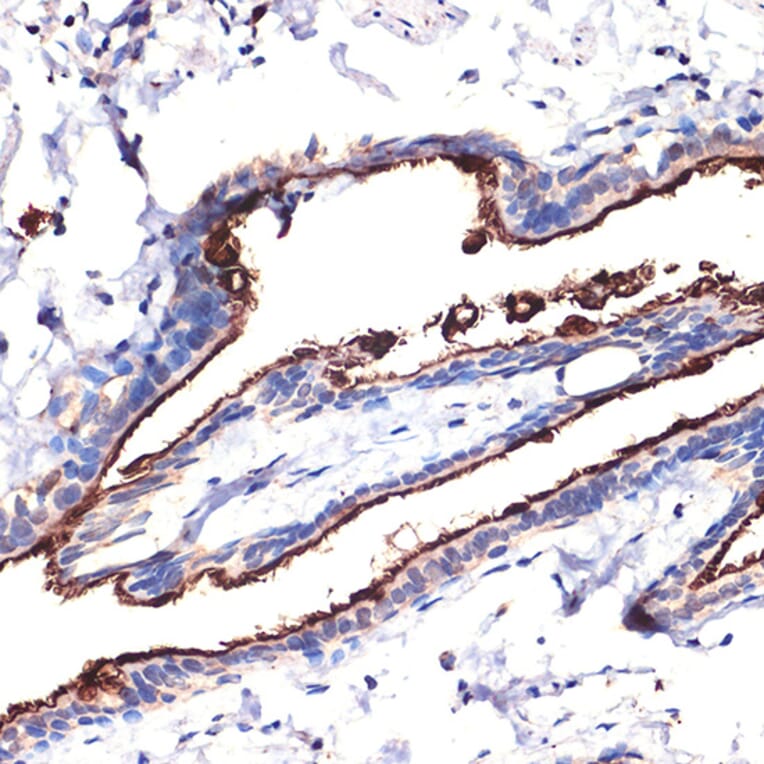Immunohistochemistry - Anti-MUC1 Antibody (A89184) - Antibodies.com