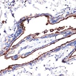 Immunohistochemistry - Anti-MUC1 Antibody (A89184) - Antibodies.com