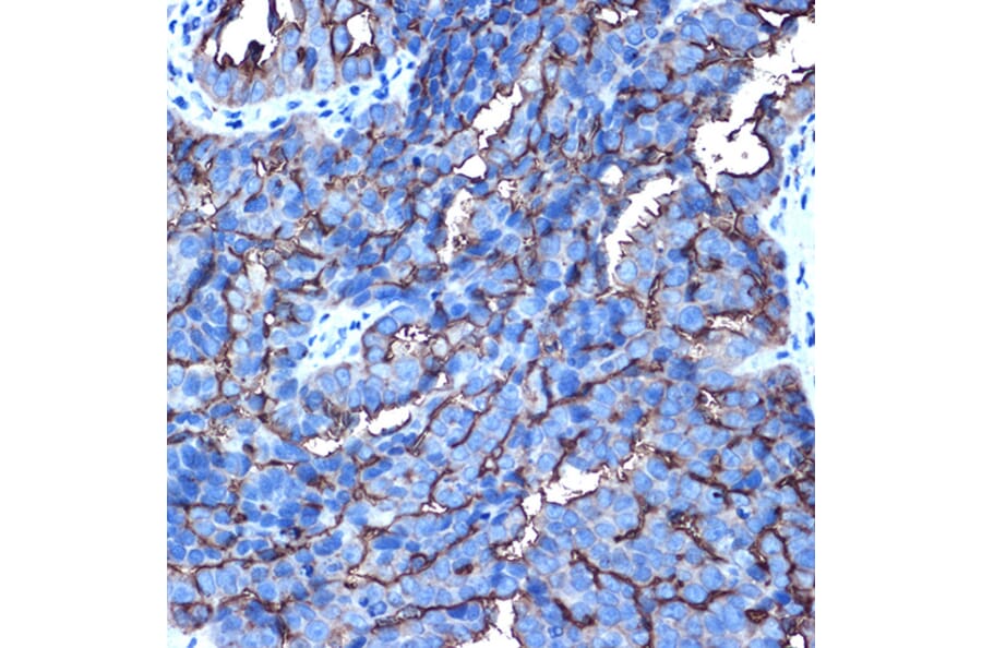 Immunohistochemistry - Anti-MUC1 Antibody (A89184) - Antibodies.com