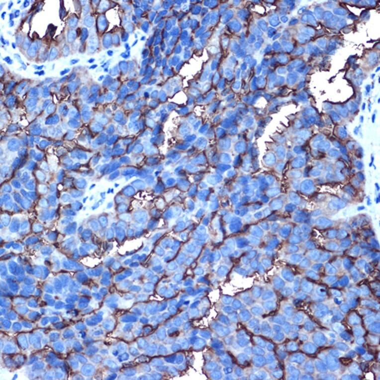 Immunohistochemistry - Anti-MUC1 Antibody (A89184) - Antibodies.com