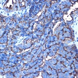 Immunohistochemistry - Anti-MUC1 Antibody (A89184) - Antibodies.com