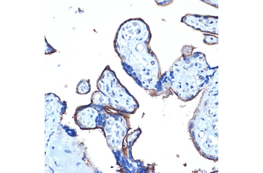 Immunohistochemistry - Anti-MUC1 Antibody (A89184) - Antibodies.com