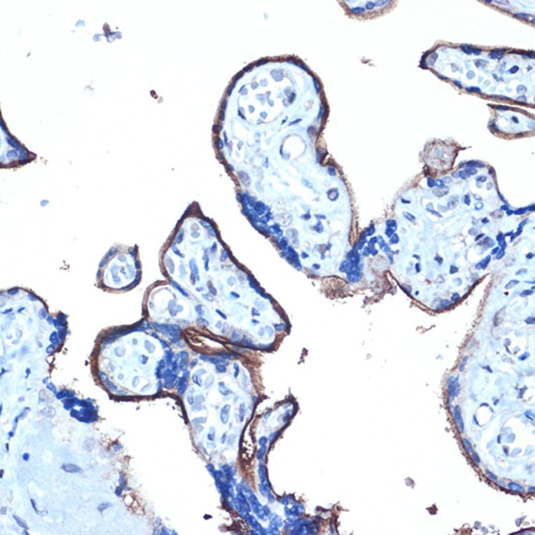 Immunohistochemistry - Anti-MUC1 Antibody (A89184) - Antibodies.com