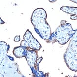 Immunohistochemistry - Anti-MUC1 Antibody (A89184) - Antibodies.com