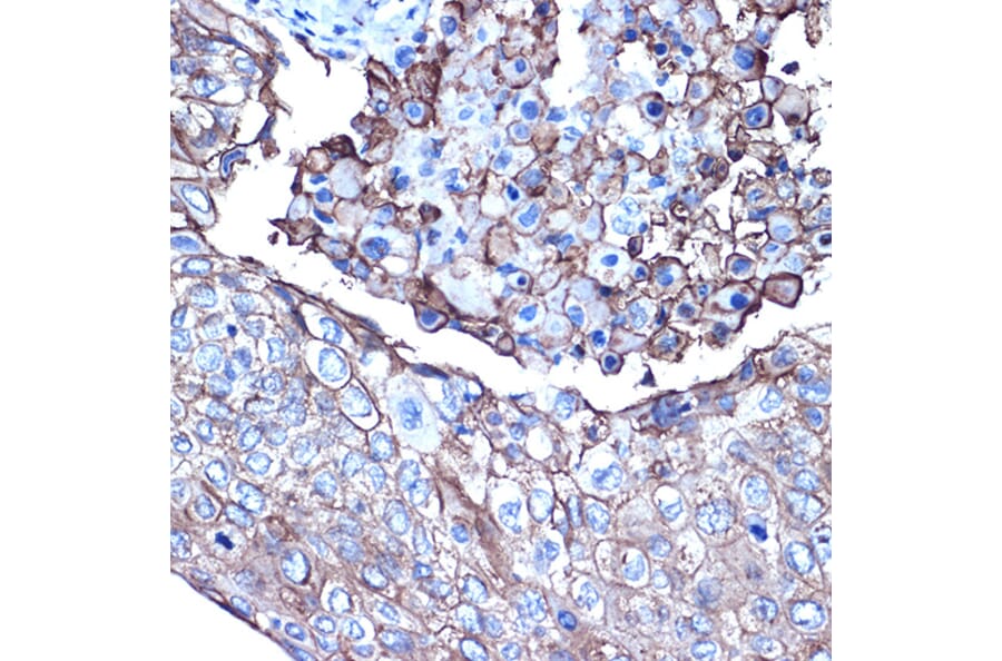Immunohistochemistry - Anti-MUC1 Antibody (A89184) - Antibodies.com