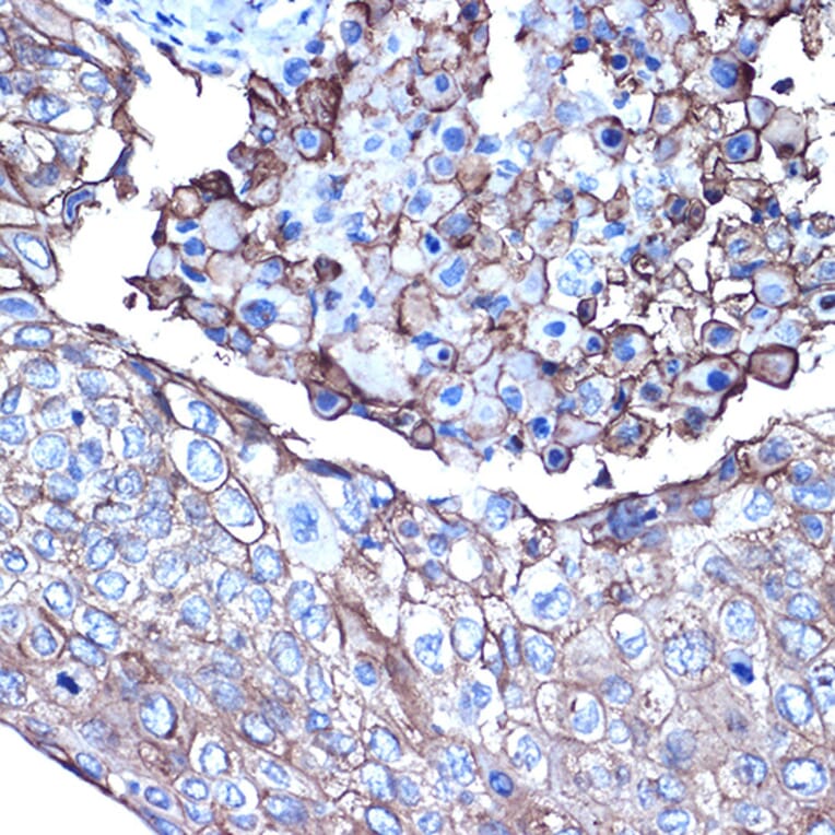 Immunohistochemistry - Anti-MUC1 Antibody (A89184) - Antibodies.com