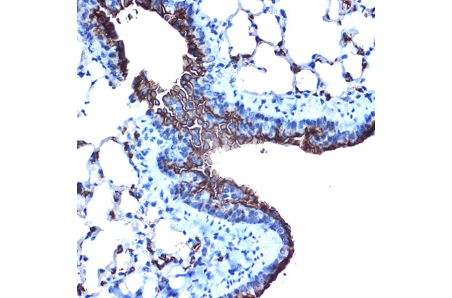 Immunohistochemistry - Anti-MUC1 Antibody (A89184) - Antibodies.com