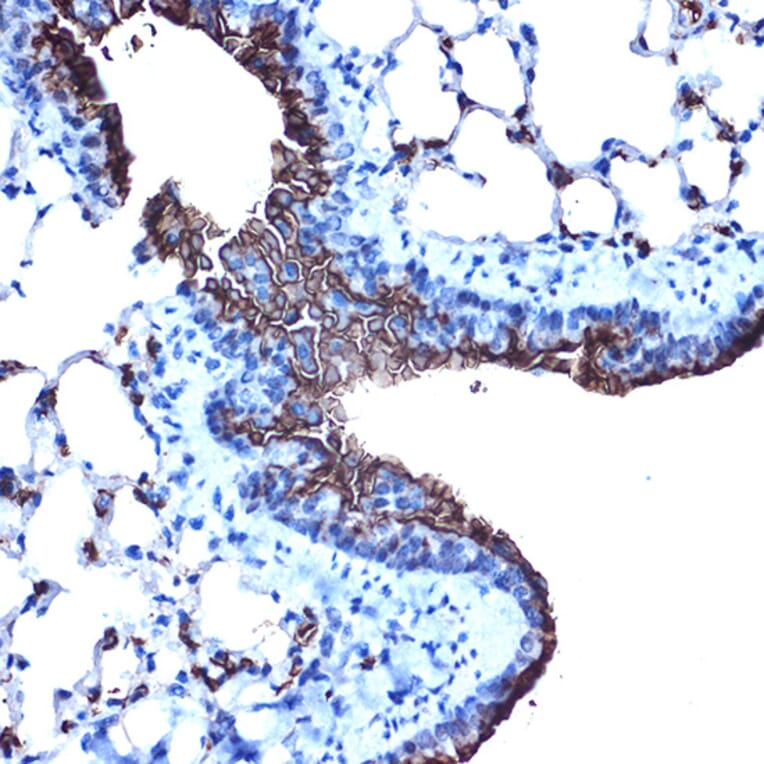 Immunohistochemistry - Anti-MUC1 Antibody (A89184) - Antibodies.com