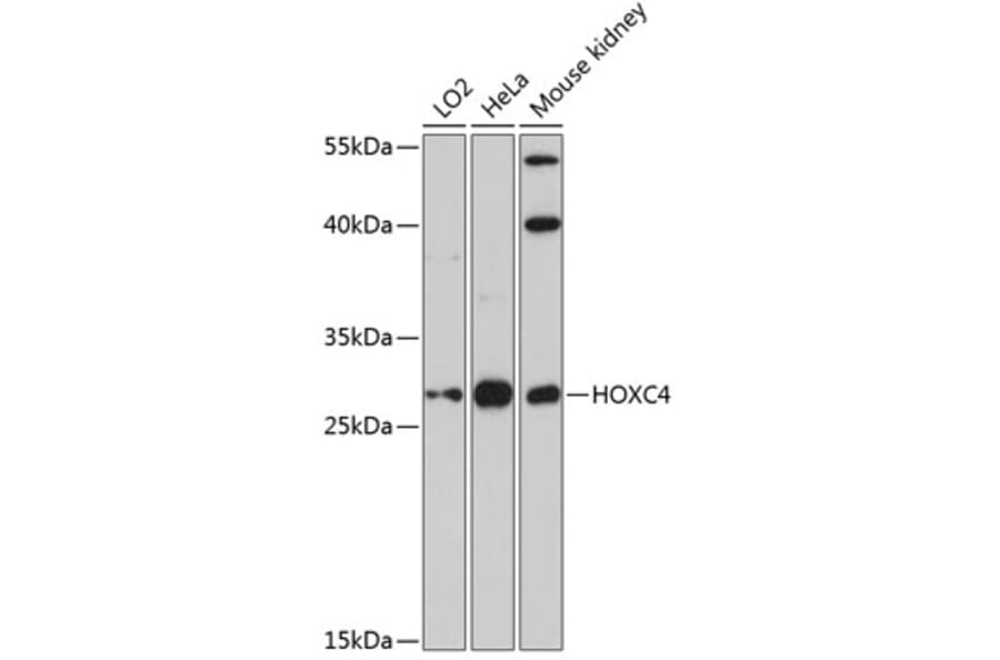 Western Blot - Anti-HOXC4 Antibody (A89185) - Antibodies.com