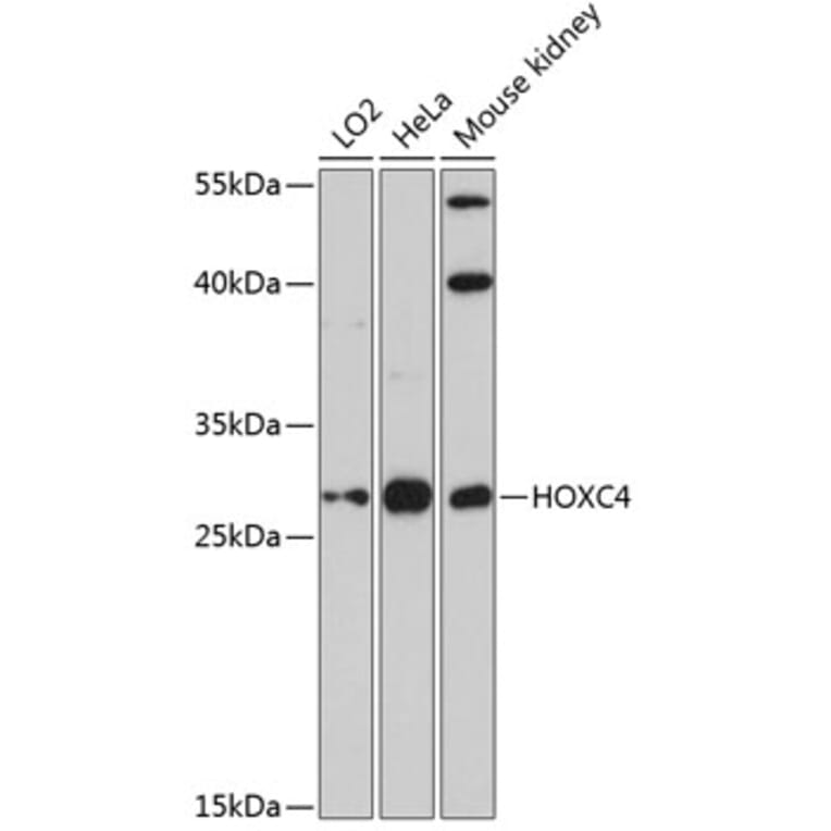 Western Blot - Anti-HOXC4 Antibody (A89185) - Antibodies.com
