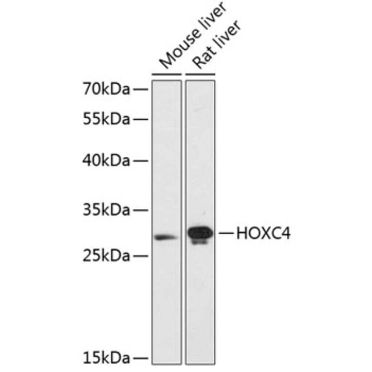 Western Blot - Anti-HOXC4 Antibody (A89186) - Antibodies.com