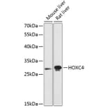 Western Blot - Anti-HOXC4 Antibody (A89186) - Antibodies.com