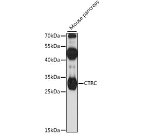 Western Blot - Anti-Chymotrypsin Antibody (A89187) - Antibodies.com