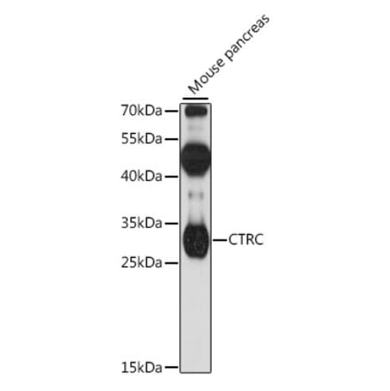 Western Blot - Anti-Chymotrypsin Antibody (A89187) - Antibodies.com