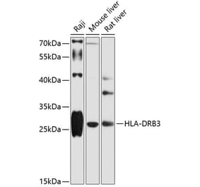 Western Blot - Anti-HLA DRB3 Antibody (A89188) - Antibodies.com