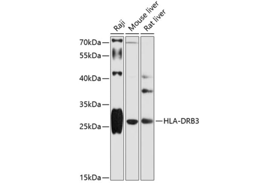 Western Blot - Anti-HLA DRB3 Antibody (A89188) - Antibodies.com