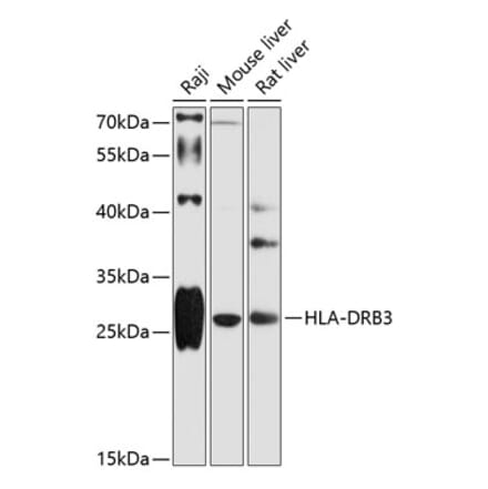 Western Blot - Anti-HLA DRB3 Antibody (A89188) - Antibodies.com