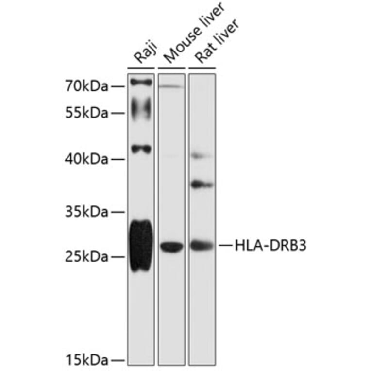 Western Blot - Anti-HLA DRB3 Antibody (A89188) - Antibodies.com