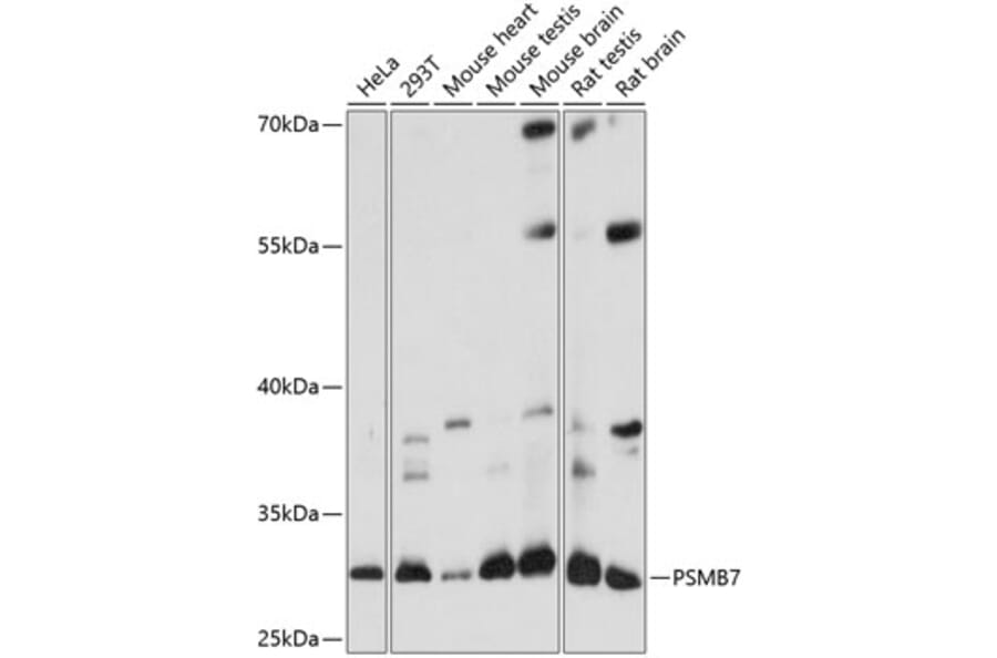 Western Blot - Anti-Proteasome 20S beta 7/PSMB7 Antibody (A89189) - Antibodies.com