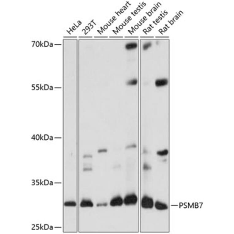 Western Blot - Anti-Proteasome 20S beta 7/PSMB7 Antibody (A89189) - Antibodies.com