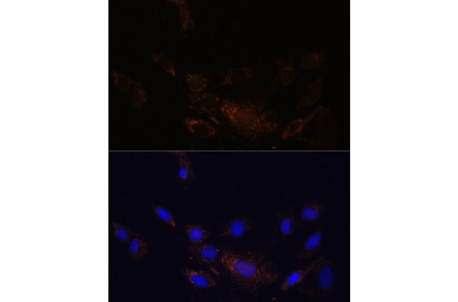 Immunofluorescence - Anti-Proteasome 20S beta 7/PSMB7 Antibody (A89189) - Antibodies.com