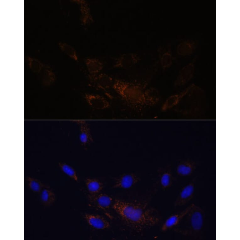 Immunofluorescence - Anti-Proteasome 20S beta 7/PSMB7 Antibody (A89189) - Antibodies.com