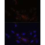 Immunofluorescence - Anti-Proteasome 20S beta 7/PSMB7 Antibody (A89189) - Antibodies.com