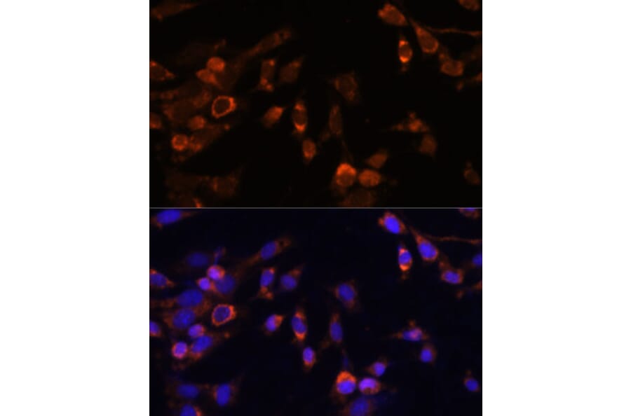 Immunofluorescence - Anti-Proteasome 20S beta 7/PSMB7 Antibody (A89189) - Antibodies.com
