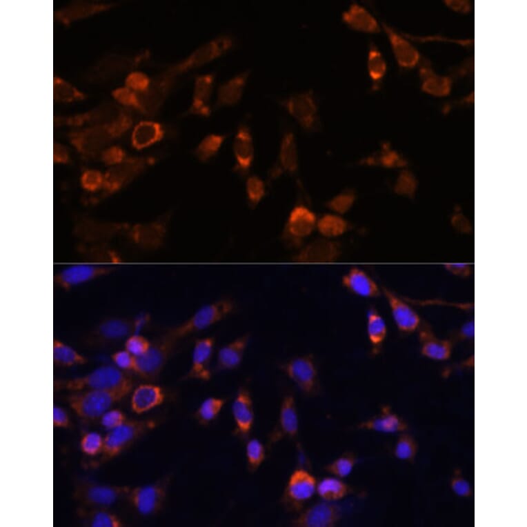 Immunofluorescence - Anti-Proteasome 20S beta 7/PSMB7 Antibody (A89189) - Antibodies.com