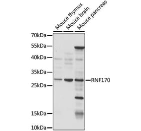 Western Blot - Anti-RNF170 Antibody (A89190) - Antibodies.com