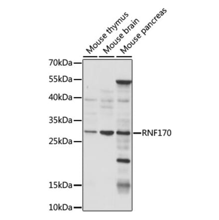 Western Blot - Anti-RNF170 Antibody (A89190) - Antibodies.com
