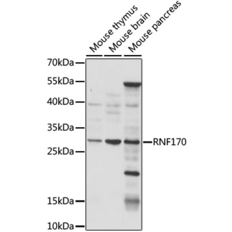 Western Blot - Anti-RNF170 Antibody (A89190) - Antibodies.com
