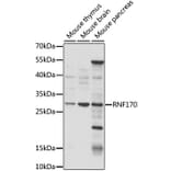Western Blot - Anti-RNF170 Antibody (A89190) - Antibodies.com