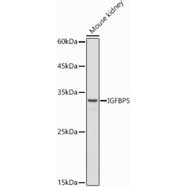 Western Blot - Anti-IGFBP5 Antibody (A89191) - Antibodies.com