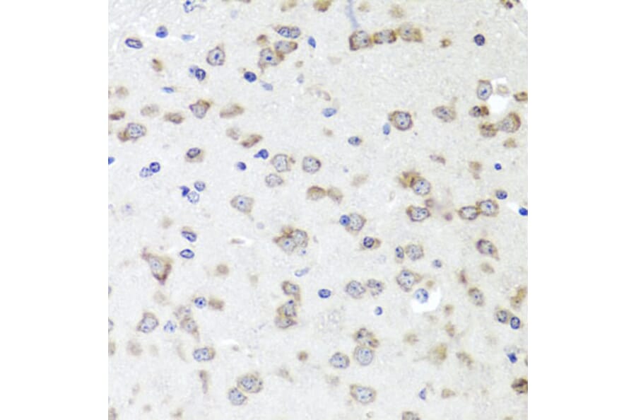 Immunohistochemistry - Anti-IGFBP5 Antibody (A89191) - Antibodies.com
