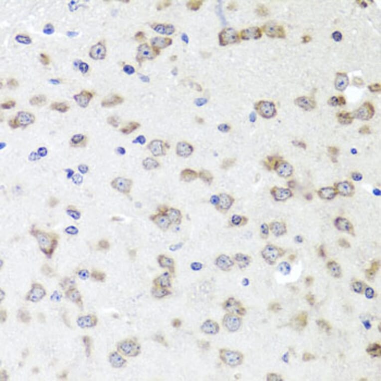 Immunohistochemistry - Anti-IGFBP5 Antibody (A89191) - Antibodies.com