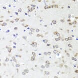 Immunohistochemistry - Anti-IGFBP5 Antibody (A89191) - Antibodies.com