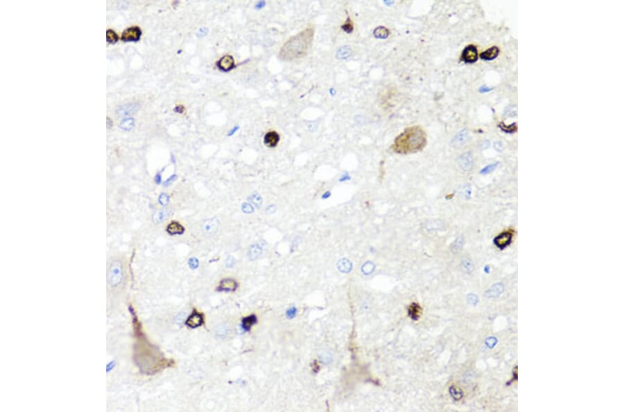 Immunohistochemistry - Anti-IGFBP5 Antibody (A89191) - Antibodies.com