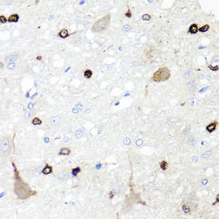 Immunohistochemistry - Anti-IGFBP5 Antibody (A89191) - Antibodies.com