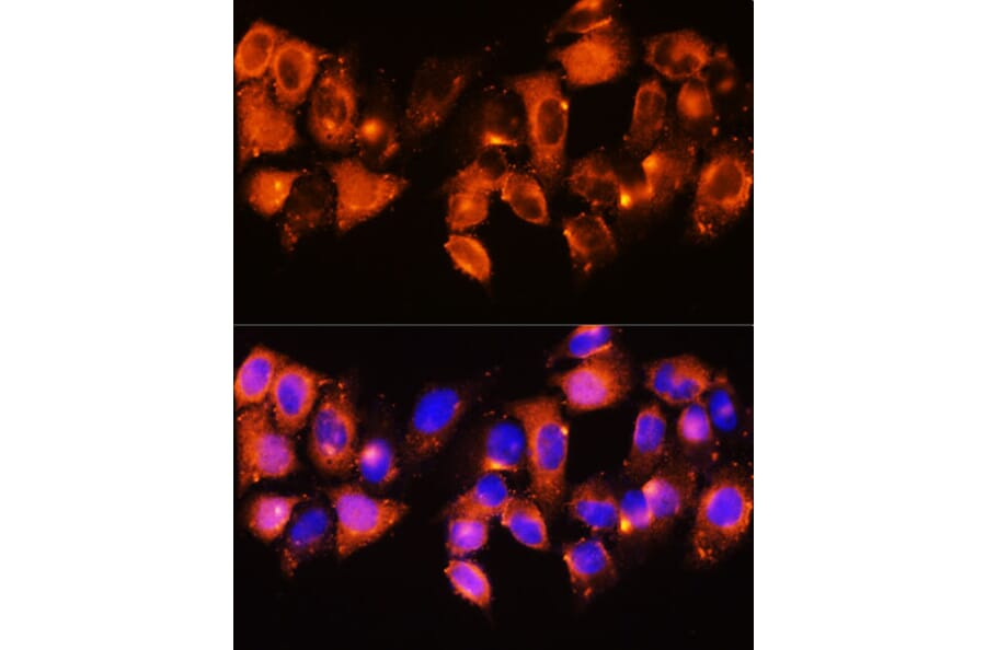 Immunofluorescence - Anti-IGFBP5 Antibody (A89191) - Antibodies.com