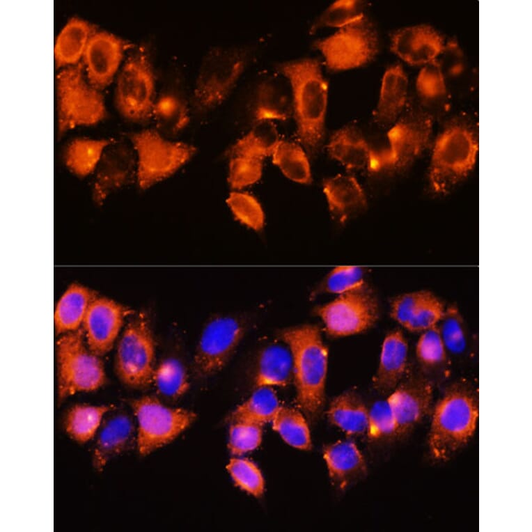 Immunofluorescence - Anti-IGFBP5 Antibody (A89191) - Antibodies.com