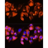 Immunofluorescence - Anti-IGFBP5 Antibody (A89191) - Antibodies.com