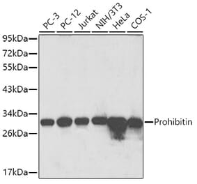 Western Blot - Anti-Prohibitin Antibody (A89192) - Antibodies.com