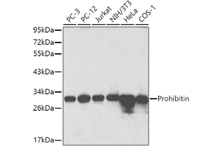 Western Blot - Anti-Prohibitin Antibody (A89192) - Antibodies.com