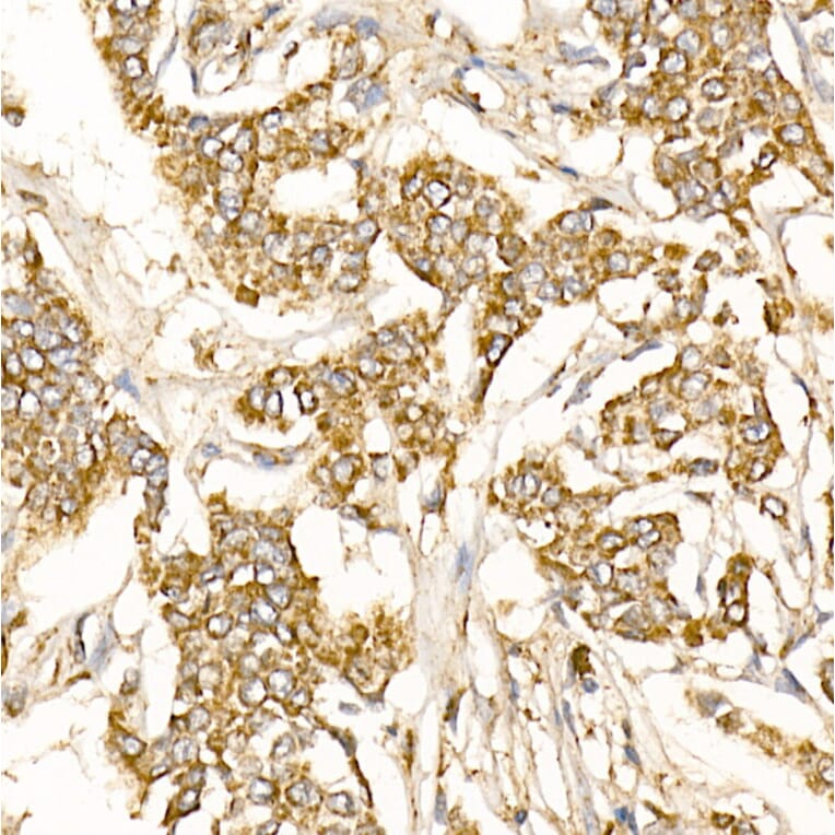 Immunohistochemistry - Anti-Prohibitin Antibody (A89192) - Antibodies.com