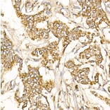 Immunohistochemistry - Anti-Prohibitin Antibody (A89192) - Antibodies.com